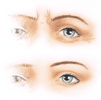 eyes and frown lines before and after botox treatment